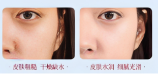 ad2df286-75f5-43fd-b2aa-809f477f1765.png